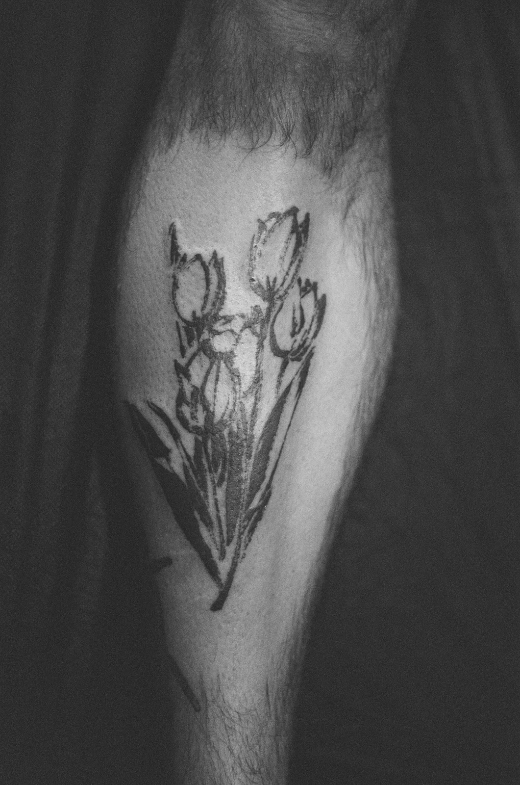 Tulip — forearm — 2025, Image 4