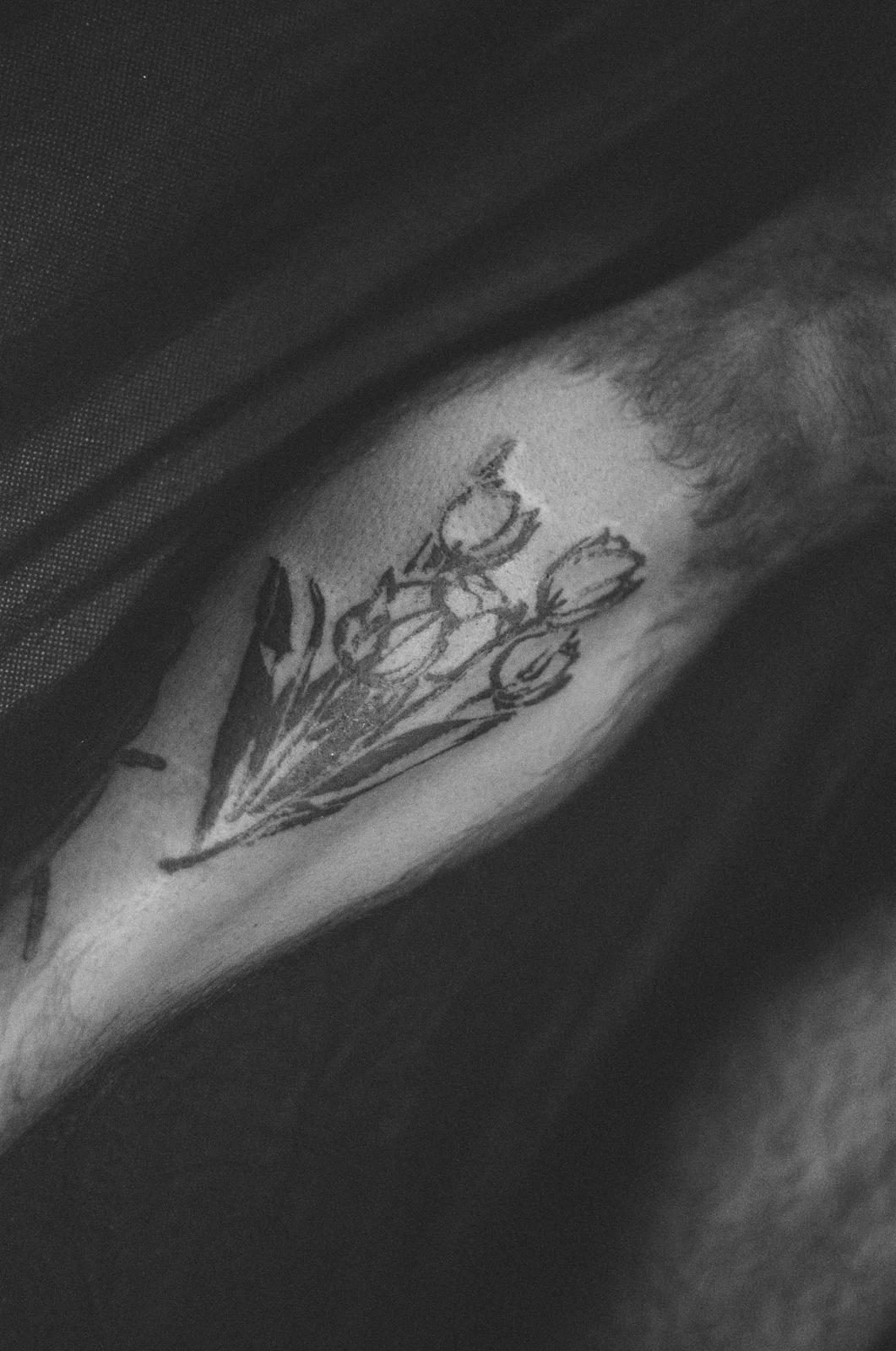Tulip — forearm — 2025, Image 2